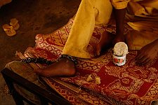 A patient of the mental hospital with his dinner ration. Hargeisa, SomaliLand, Monday, October 8, 2007. The only mental hospital in the country has a male and a female wards with about a hundred patients altogether.